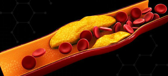 Cholesterol - cholesterín