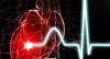 Výrobok znižuje riziko srdcového infarktu