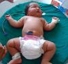 6 až 8 kg: najväčší novorodenci na svete