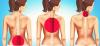 Ako sa zbaviť bolesti chrbta s cvičením