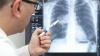 Lekár porovnáva radiačnú expozíciu s CT pľúc s radiáciou v Hirošime