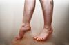 Narušenie prietoku krvi v nohách: príčiny, príznaky