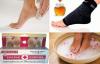 Ako sa zbaviť nohy drsnej pokožky a zabrániť jej deje