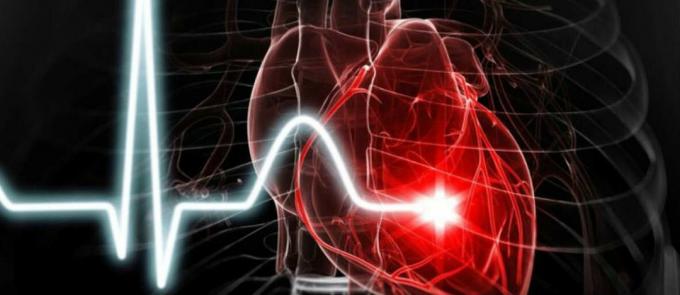 Srdcový infarkt - srdcový infarkt