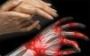 Príznaky a príčiny reumatoidnej artritídy ako varovať