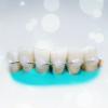 Populárne dlahovanie zuby: koľko to efektívne?