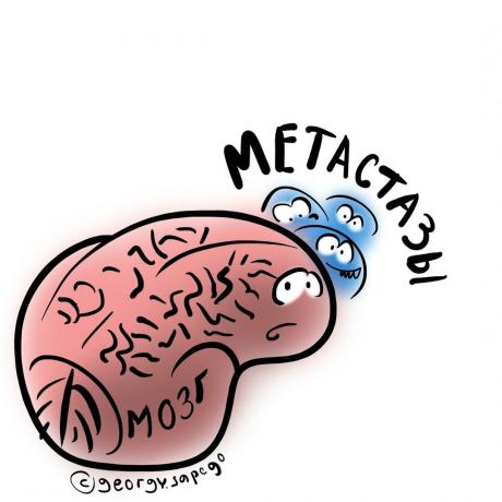 mozgové metastázy