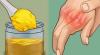 Ako sa zbaviť bolesti v kĺboch ​​rúk