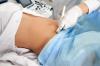 Ako často musíte urobiť ultrazvuk počas tehotenstva, hovorí lekár