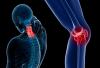 5 náznaky, že máte začína osteoporózy